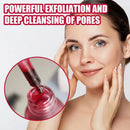 Soro de ácido salicílico tratamento de acne poros suaves clareamento soro para pele oleosa hidratante produto de cuidados com a pele