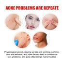 200/400 pces remendos de acne capa de espinha invisível para tratamento de ponto de controle de óleo facial adesivo bonito para cobrir espinhas e manchas