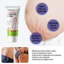 Creme para Remover Estrias de Gravidez, Melhora a Elasticidade, Suaviza Linhas de Crescimento, Nutre, Hidrata e Firma a Pele