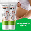 Creme para Remover Estrias de Gravidez, Melhora a Elasticidade, Suaviza Linhas de Crescimento, Nutre, Hidrata e Firma a Pele