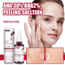 Soro de ácido salicílico tratamento de acne poros suaves clareamento soro para pele oleosa hidratante produto de cuidados com a pele